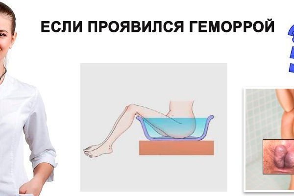 Как заказать на кракене